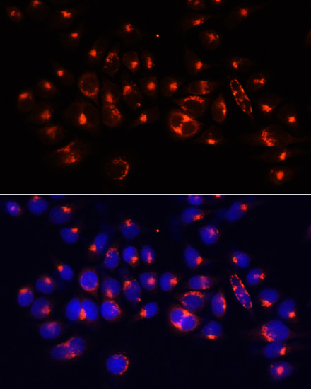 Anti-AARS Antibody (CAB15017)