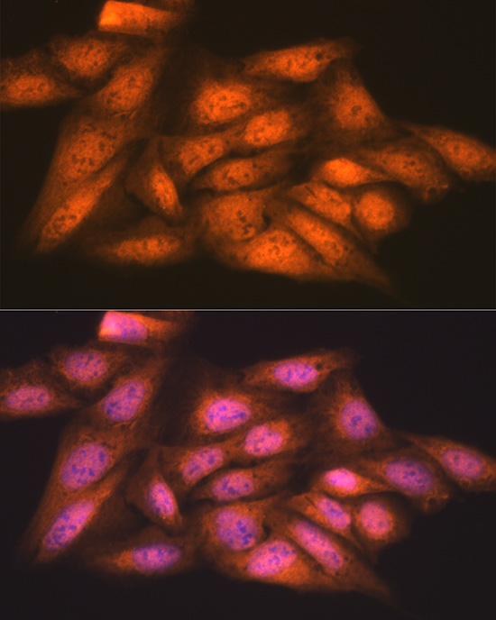 Anti-ASC / TMS1 Antibody (CAB11433)