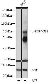 Anti-Phospho-EZR-Y353 Antibody (CABP1118)