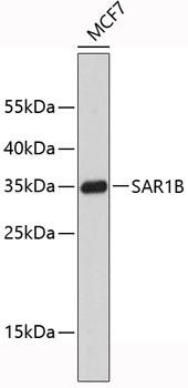 Western blot analysis of extracts of MCF-7 cells, using SAR1B antibody . Secondary antibody: HRP Goat Anti-Rabbit IgG (H+L) at 1:10000 dilution. Lysates/proteins: 25ug per lane. Blocking buffer: 3% nonfat dry milk in TBST.