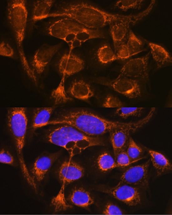 Anti-CFP Antibody (CAB5398)