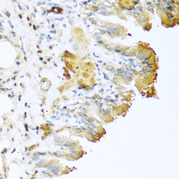 Anti-VTN Antibody (CAB1667)