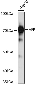 Anti-AFP Mouse Monoclonal Antibody (CAB17898)