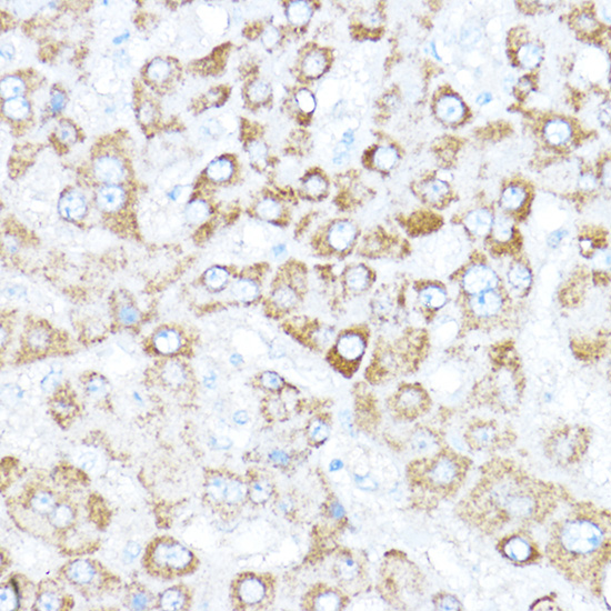 Anti-ZBTB33 Antibody (CAB12856)