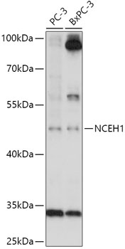 Anti-NCEH1 Antibody (CAB17741)