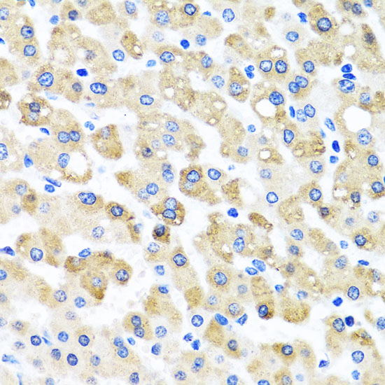 Anti-SNAP29 Antibody (CAB4290)