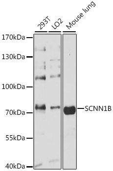 Anti-SCNN1B Antibody (CAB1765)