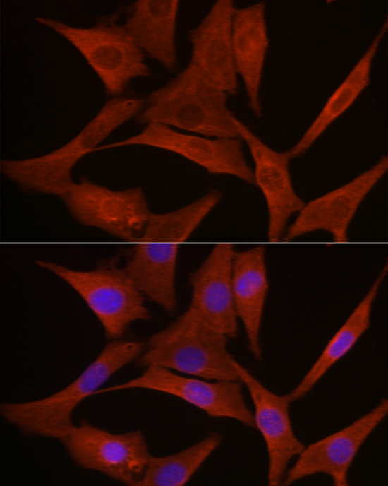 Anti-MyD88 Antibody (CAB16889)