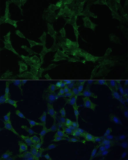 Anti-CAMLG Antibody (CAB13720)