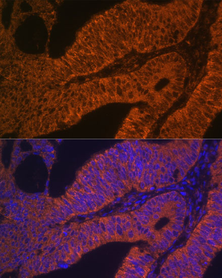 Anti-RAB5B Antibody (CAB7447)