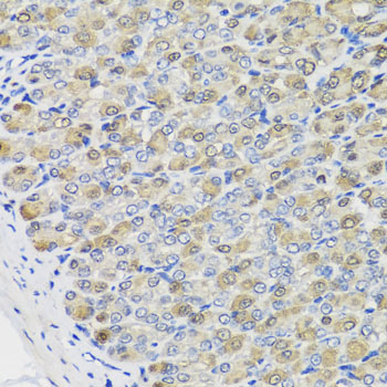 Anti-CBR3 Antibody (CAB7545)