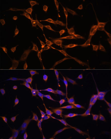 Anti-AMPKAlpha2 Antibody [KO Validated] (CAB7339)