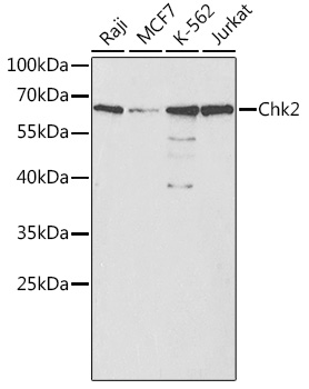 Anti-Chk2 Antibody (CAB0466)