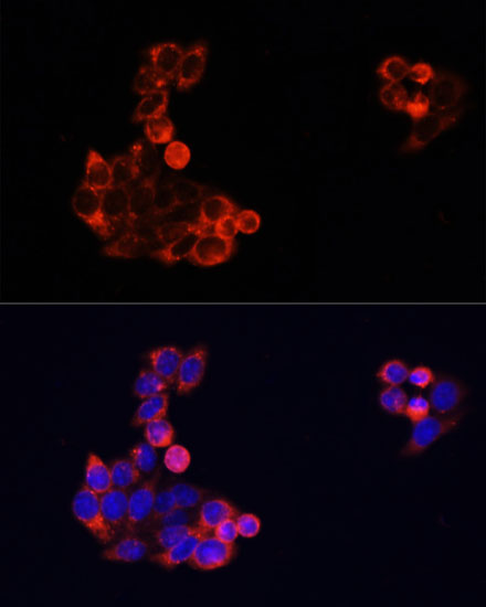 Anti-EGFR Antibody [KO Validated] (CAB11577)