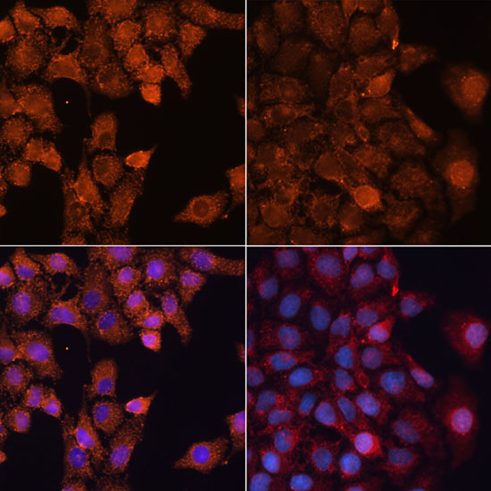 Anti-LC3A / LC3B Antibody (CAB15591)