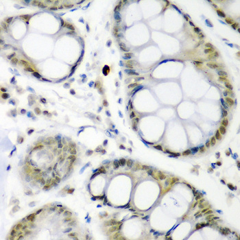 Anti-CDC27 Antibody (CAB1954)