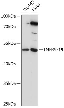 Anti-TNFRSF19 Antibody (CAB14284)