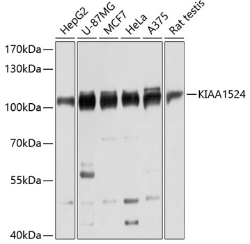 Anti-KIAA1524 Antibody (CAB12267)