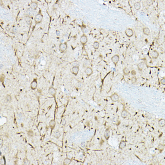 Anti-DUSP6 Antibody (CAB3171)