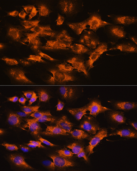 Anti-ARRB2 Antibody (CAB1171)