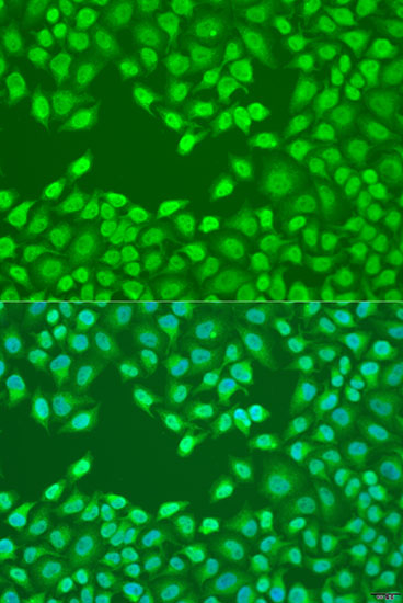 Anti-FZD4 Antibody (CAB15113)