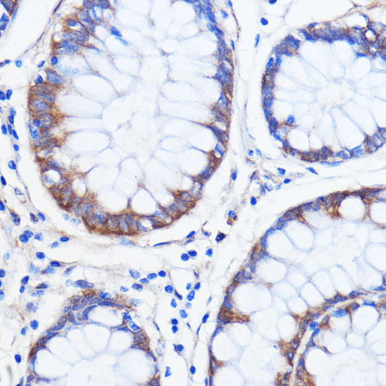 Anti-ATXN2 Antibody (CAB16666)