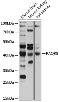 Anti-PAQR8 Antibody (CAB12221)