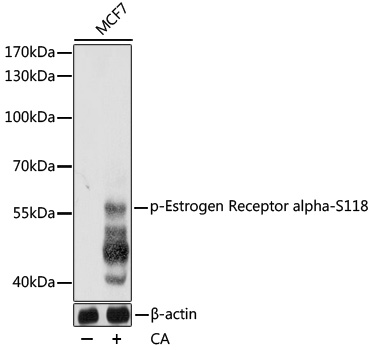 Anti-Phospho-Estrogen receptor-S118 Antibody (CABP0146)