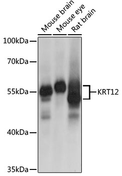 Anti-KRT12 Polyclonal Antibody (CAB9642)