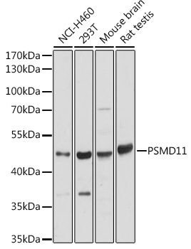 Anti-PSMD11 Antibody (CAB15306)