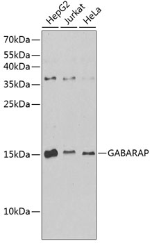 Anti-GABARAP Antibody (CAB12568)