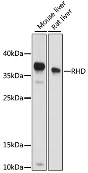 Anti-RHD Antibody (CAB15092)