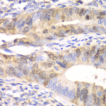 Anti-UBE2C Antibody (CAB5499)