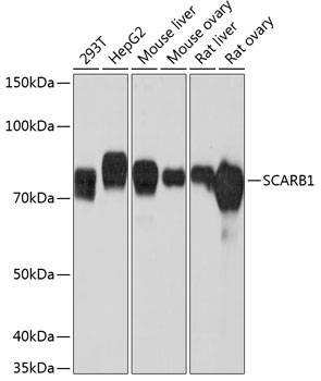 Anti-SCARB1 Antibody