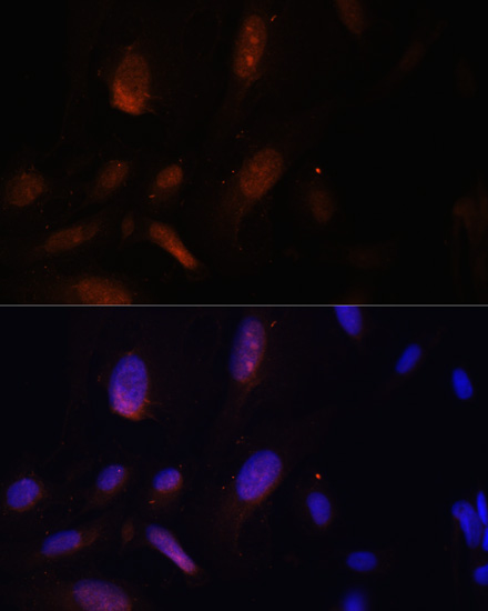 Anti-ZNF574 Antibody (CAB14923)