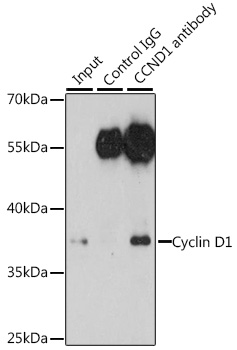 Anti-Cyclin D1 Antibody (CAB11022)