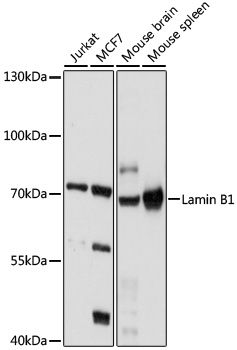 Anti-LMNB1 Antibody (CAB16685)