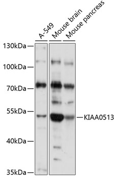 Anti-KIAA0513 Antibody (CAB14647)