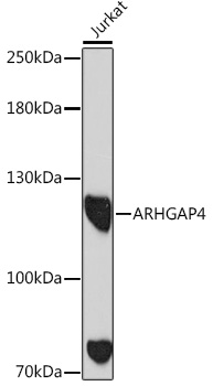 Anti-ARHGAP4 Antibody (CAB18338)