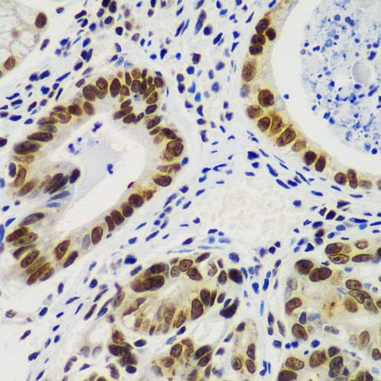 Anti-RING1B/RNF2 Antibody (CAB5563)