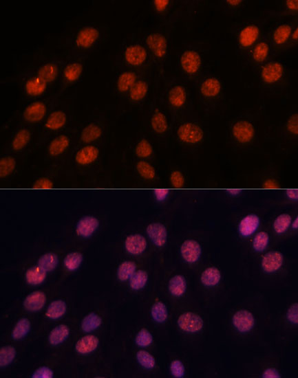 Anti-IPO8 Antibody (CAB14679)