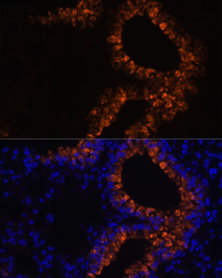 Anti-SCGB1A1 Antibody (CAB16997)