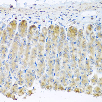 Anti-TAMM41 Polyclonal Antibody (CAB8374)