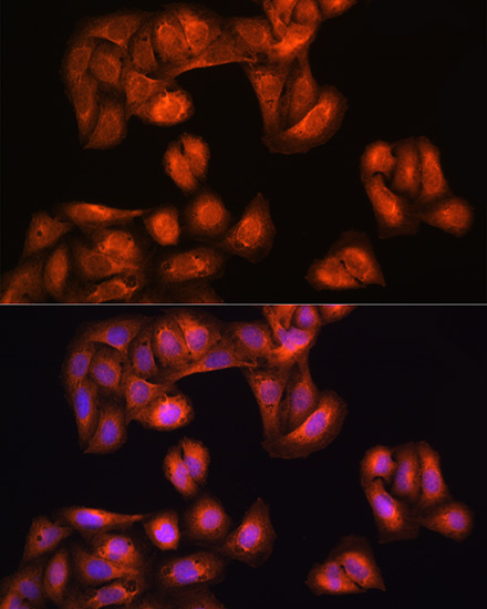 Anti-PHGDH Antibody (CAB10461)