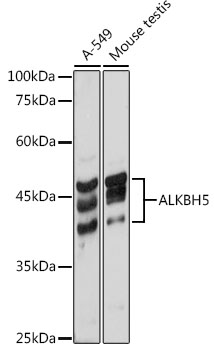 Anti-ALKBH5 Antibody (CAB11684)