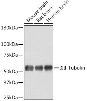 Anti-BetaIII-Tubulin Antibody