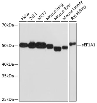 Anti-eEF1A1 Antibody