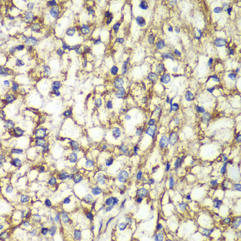 Anti-PTGES2 Antibody (CAB7137)