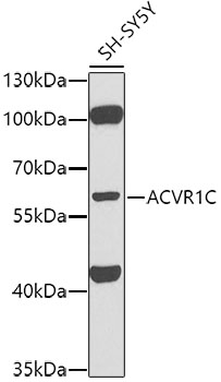 Anti-ACVR1C Antibody (CAB0678)