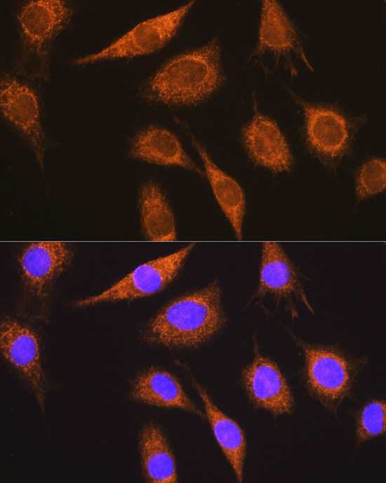 Anti-MUT Antibody (CAB3969)